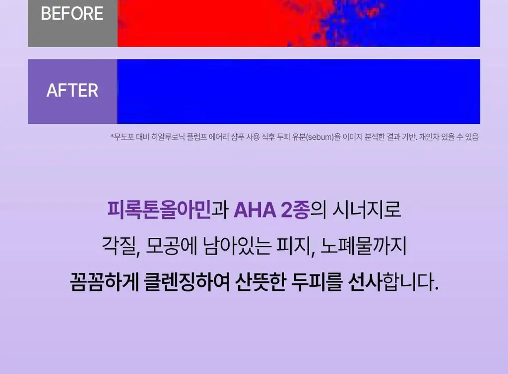 [+미니증정/수분볼륨UP]로레알파리 히알루론산 두피앰플샴푸 440ml 단품/기획(약산성) 상세페이지 12